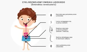 Skąd się biorą owsiki i jak uniknąć zarażenia nimi?