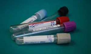 Co to jest APTT w badaniu krwi? Normy, przyczyny odchyleń i znaczenie diagnostyczne