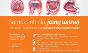 Choroby jamy ustnej: do jakiego lekarza się udać i jak uniknąć powikłań