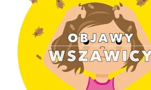 Jak skutecznie zapobiec wszawicy – praktyczne porady i metody ochrony