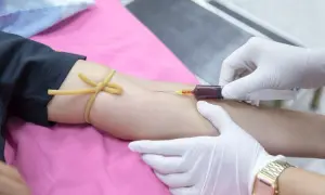 Kiedy odstawić żelazo przed badaniem krwi, aby uniknąć błędów?