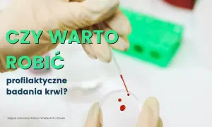 Badania krwi, które warto zrobić – kluczowe testy dla zdrowia i profilaktyki