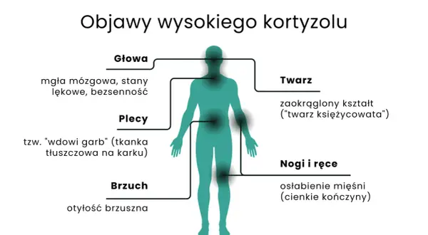 Objawy wysokiego kortyzolu: mgła mózgowa, "twarz księżycowata", garb, otyłość brzuszna, osłabienie mięśni.