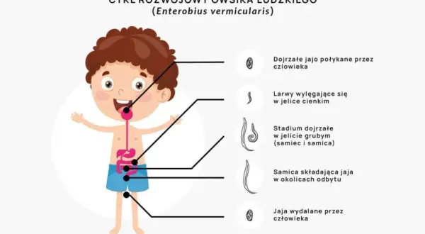 Skąd się biorą owsiki i jak uniknąć zarażenia nimi?