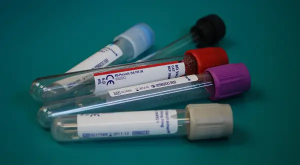 Co to jest APTT w badaniu krwi? Normy, przyczyny odchyleń i znaczenie diagnostyczne