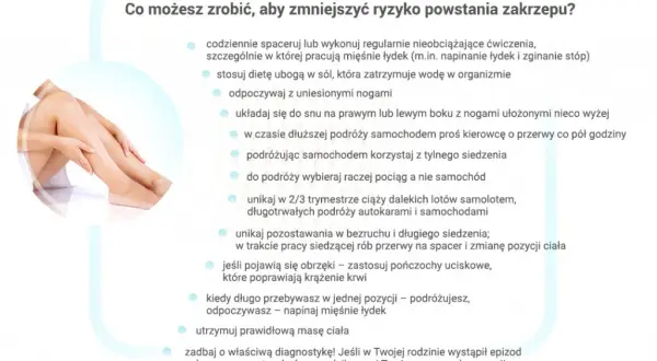 Jak zapobiec zakrzepicy: skuteczne metody i proste zmiany w stylu życia