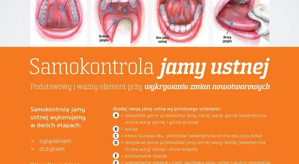 Choroby jamy ustnej: do jakiego lekarza się udać i jak uniknąć powikłań