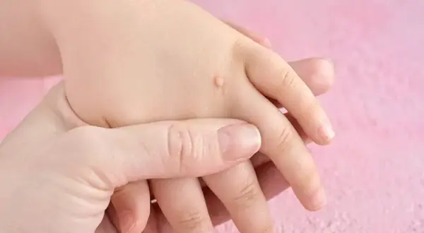 Skąd się biorą kurzajki? Poznaj przyczyny i skutki zakażenia HPV