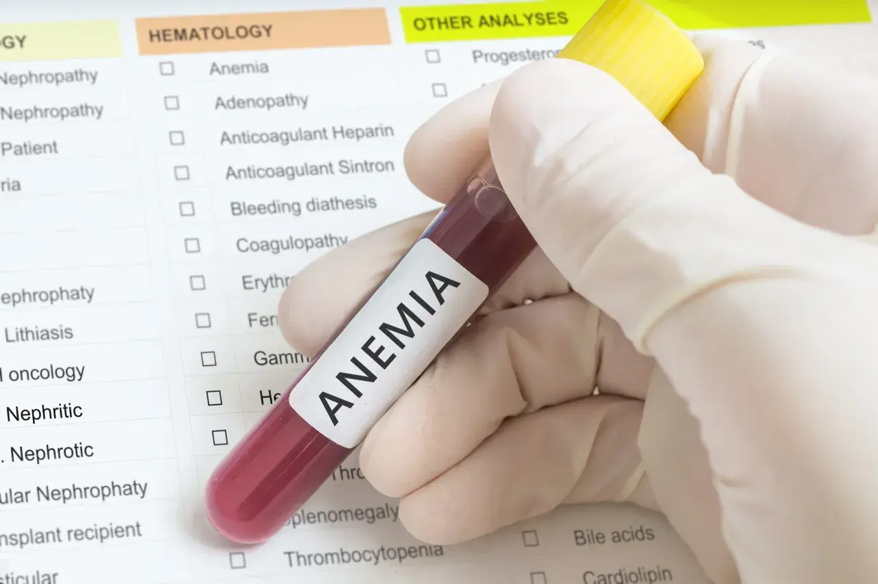 Ręka w rękawiczce trzyma probówkę z krwią z napisem "ANEMIA". Obok znajduje się lista badań, gdzie zaznaczono "Anemia", sugerując diagnostykę i poszukiwanie sposobów, jak leczyć anemię.