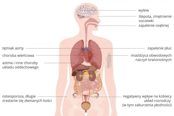 Schemat układu oddechowego i innych narządów, z zaznaczonymi chorobami, np. astmą.